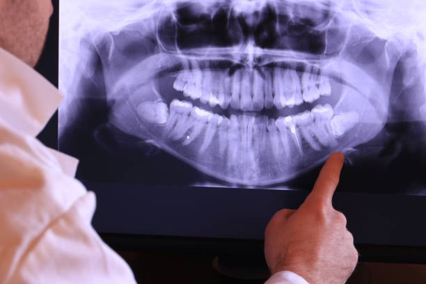 Best Emergency Dental Services for Seniors in Colfax, IA