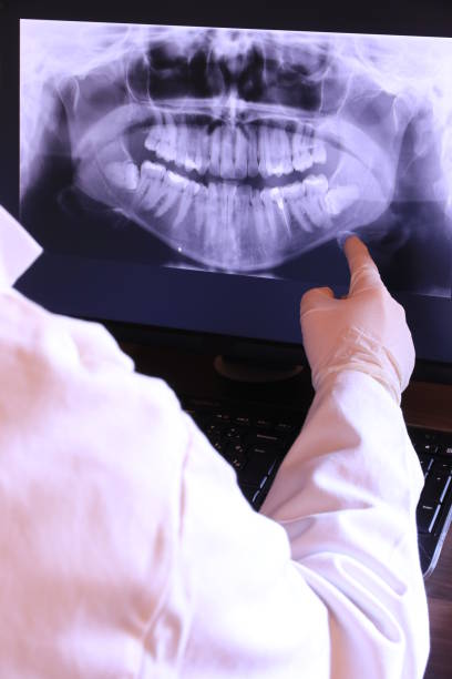 Best Emergency Dental Care for Abscessed Tooth in Colfax, IA